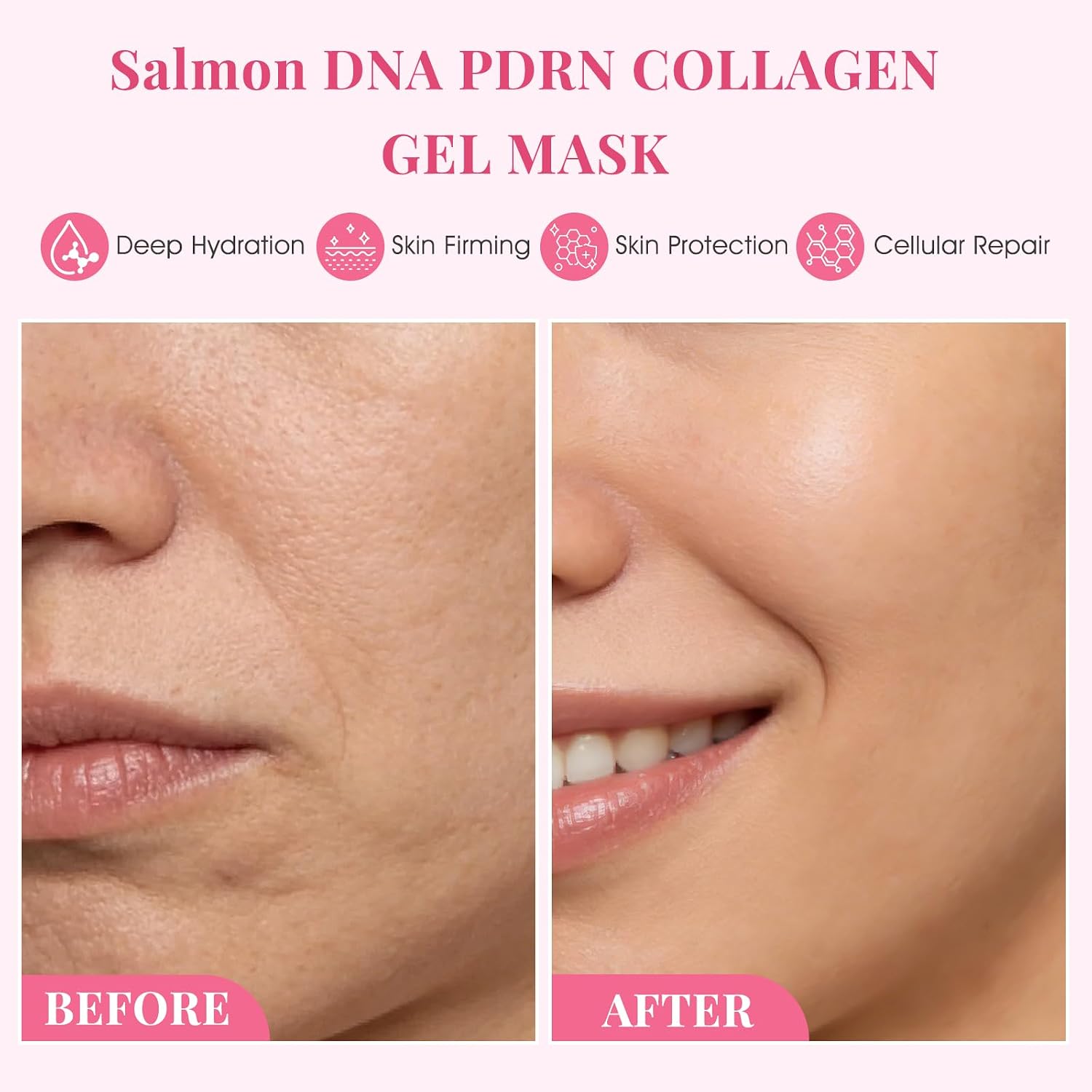 SPRINGSKY Salmon DNA PDRN Face Mask with 7D Hyaluronic Acid | 24H Hydration Collagen Mask | Firming & Smoothing Skincare | Overnight Gel Mask for All Skin Types, Sensitive Skin Friendly (6ea)