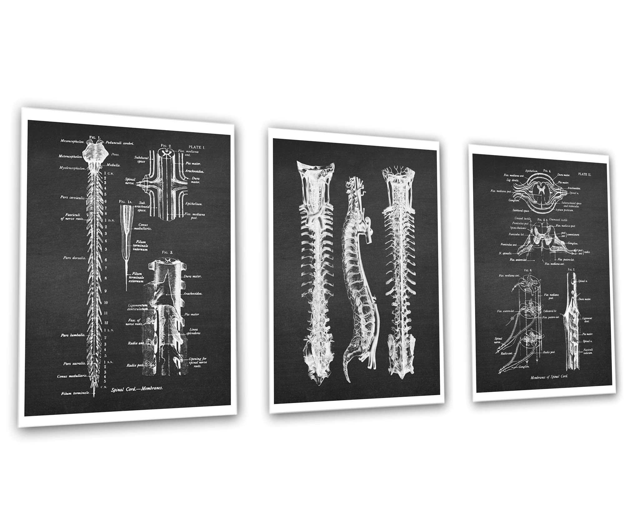 Gnosis Picture Archive Neurology Anatomy of Spinal Cord
