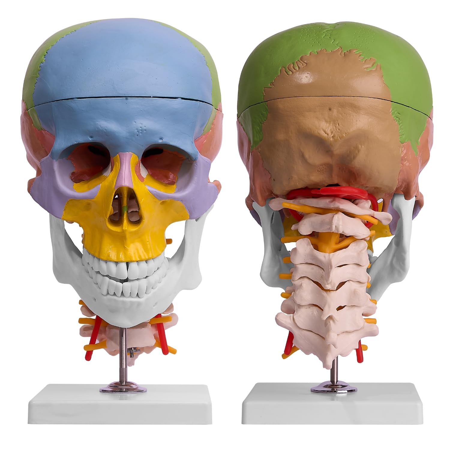 Skull Model, Painted Human Skull Anatomy Model with Cervical Vertebrae, Nerves, Arteries, Removable Skull Cap, Articulated Mandible, Teeth and Braces, Life Size Skull Anatomy Model