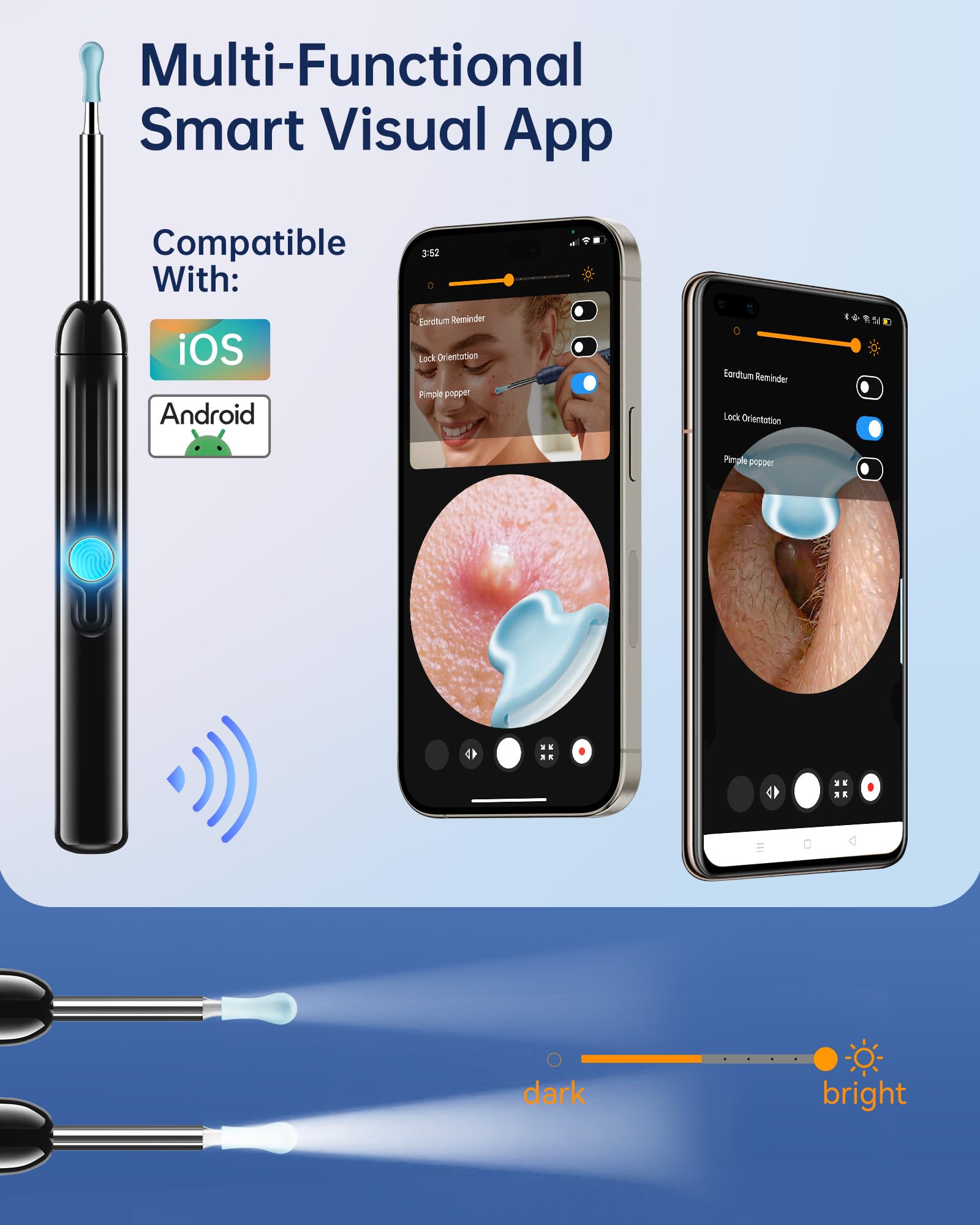 Herramienta de eliminación de cera de oído, alcance HD 1296P y 6 luces LED, limpiador de oídos con cámara, kit de limpieza de oídos, herramienta de eliminación de cerumen con 10 cucharas (ónix)