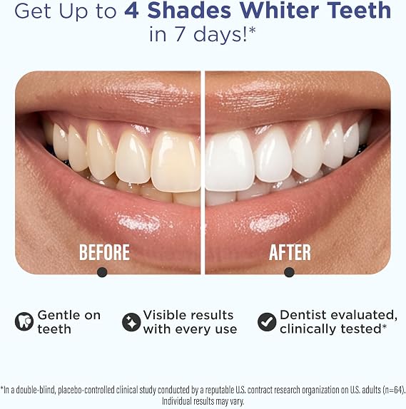 GuruNanda Teeth Whitening Strips Kit - 7-Day Treatment with Non-Slip, Dry Strip Technology - Whitening Designed with Care for a Brighter Smile