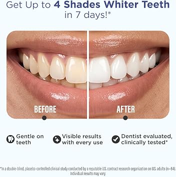 GuruNanda Teeth Whitening Strips Kit - 7-Day Treatment with Non-Slip, Dry Strip Technology - Whitening Designed with Care for a Brighter Smile