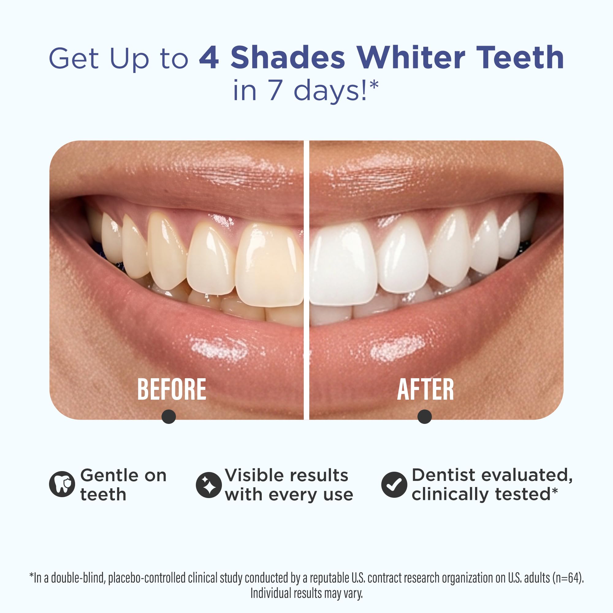 GuruNanda Teeth Whitening Strips - 4X Whiter Teeth -2