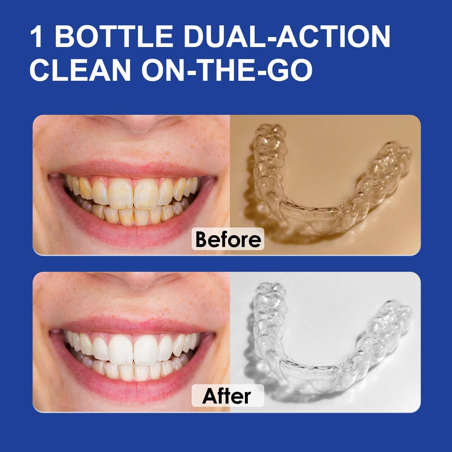 MySmile 2-in-1 Aligner/Retainer Cleaner & Teeth Whitening Foam, Great for Aligner, Retainer, Denture, Invisalign, Mouth Guard, Whitens Teeth, Kills Germs, Fights Bad Breath, Travel-Friendly
