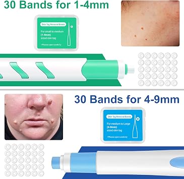 REOKILY Skin Tag Removal Kit with Pen 2-in-1 Skin Tag Remover for 1-9mm Skin Tags Fast Wart Remover and Mole Remover with 60 Bands + 36 Repair Skin Tag Removal Patches for Face, Body Within 3-14 Days