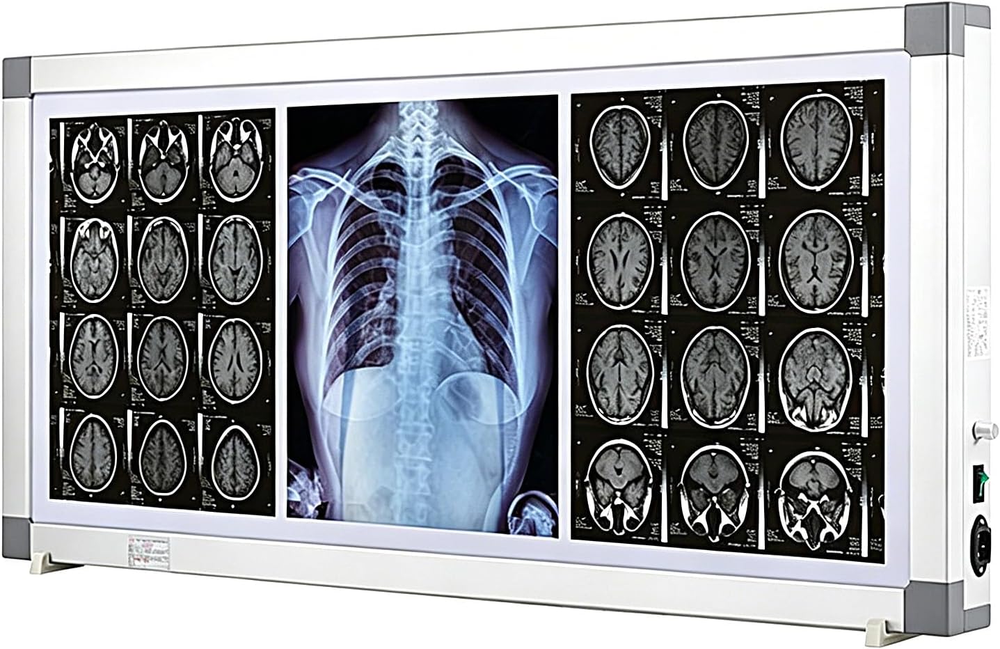 X-Ray Led Film Viewer Wall Mounting Illuminatorss Light Box Aluminum Frame and Acrylic Panel Adjustable Brightness X-Ray Viewbox for Hospitals and Clinics(110x6.5x51cm/43.3x2.6x20.1in)