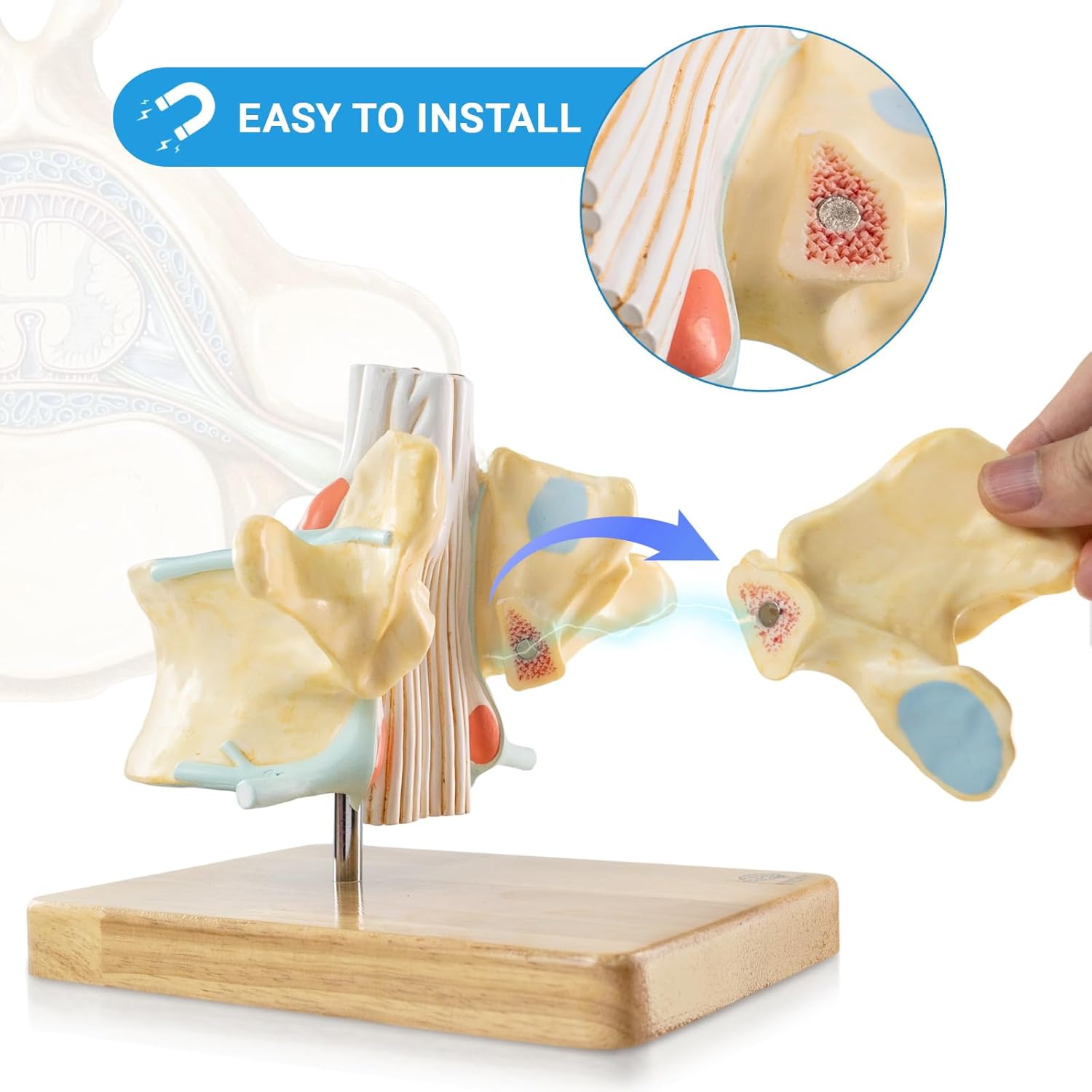 EVOTECH SCIENTIFIC Enlarged Human Lumbar Vertebra Model with Spinal Cord & Cauda Equina – 2 Times 2 Parts Detachable Spine Model on Base with Manual - Anatomy Model for Medical Students Clinicians