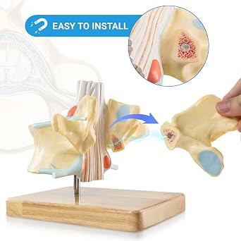 EVOTECH SCIENTIFIC Enlarged Human Lumbar Vertebra Model with Spinal Cord & Cauda Equina 2 Times 2 Parts Detachable Spine Model on Base with Manual - Anatomy Model for Medical Students Clinicians