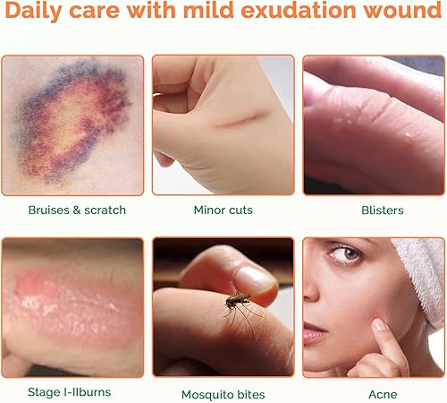 Miniatura 6 de Vendajes hidrocoloides de 2 x 2 pulgadas con borde fino, apósito hidrocoloide autoadhesivo impermeable, apósito hidrocoloide altamente absorbente