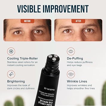 Cardon | Dark Circle Rescue for Men and Women | Under Eye Roller Eye Stick Massager for Puffy Eyes, Dark Circles, Bags, Wrinkles | Made with Peptides, Niacinamide, Hyaluronic Acid
