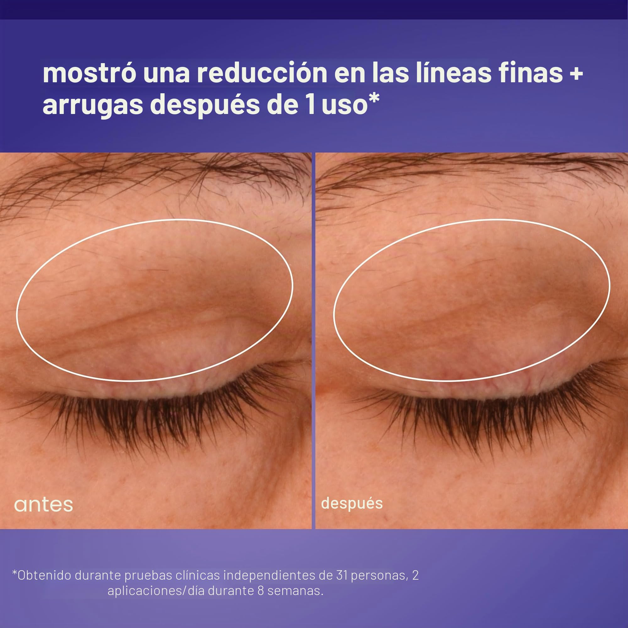 Dermalogica Phyto Nature Contorno de Ojos Efecto Lifting 15ml | Contorno de ojos con péptidos que ayuda a liftar, reafirmar y alisar el contorno del ojo.