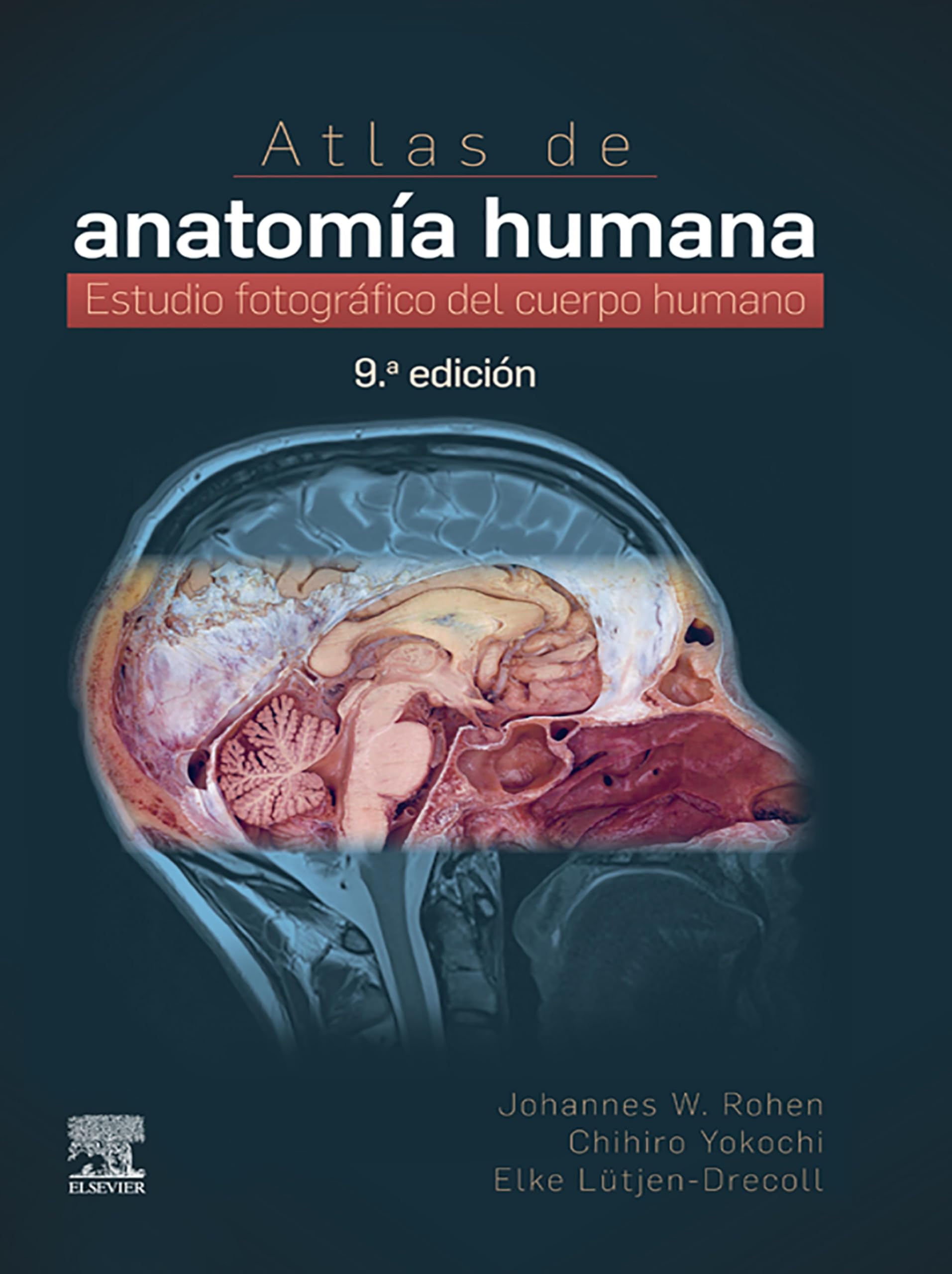 Atlas of Organ Transplantation (DVDなし） Atlas of Organ Transplantation (DVDなし） Atlas of Organ
