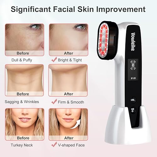 Miniatura 6 de Dispositivo facial Microcurrente, Vowleike 10 beneficios clave para el cuidado de la piel masajeador facial con soporte, herramienta facial