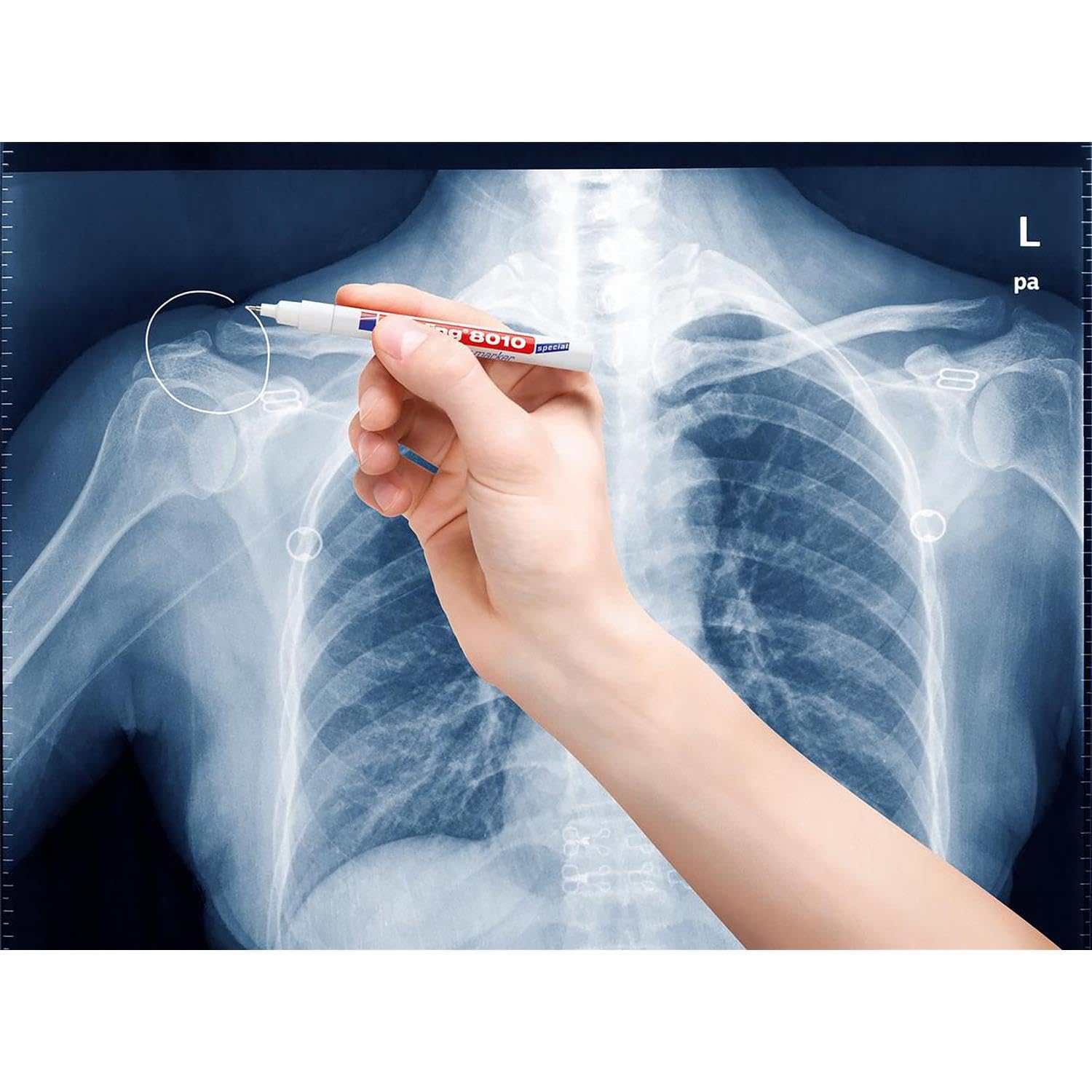 Edding Radiologie-Marker 8010, feine Spitze, 0,8 mm, Weiß, 5 Stück