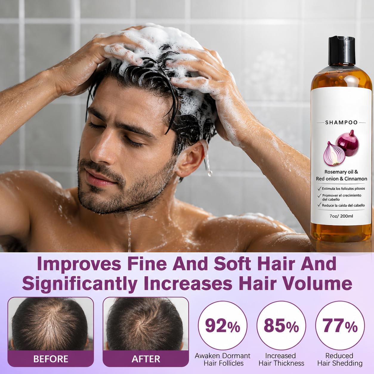 Shampoo De Cebolla, Onion Shampoo Para Hombre With Rosemary Oil, Red Onion, Cinnamon Extract, Fortify Hair Roots and Reduce Hair Fall (200ml)