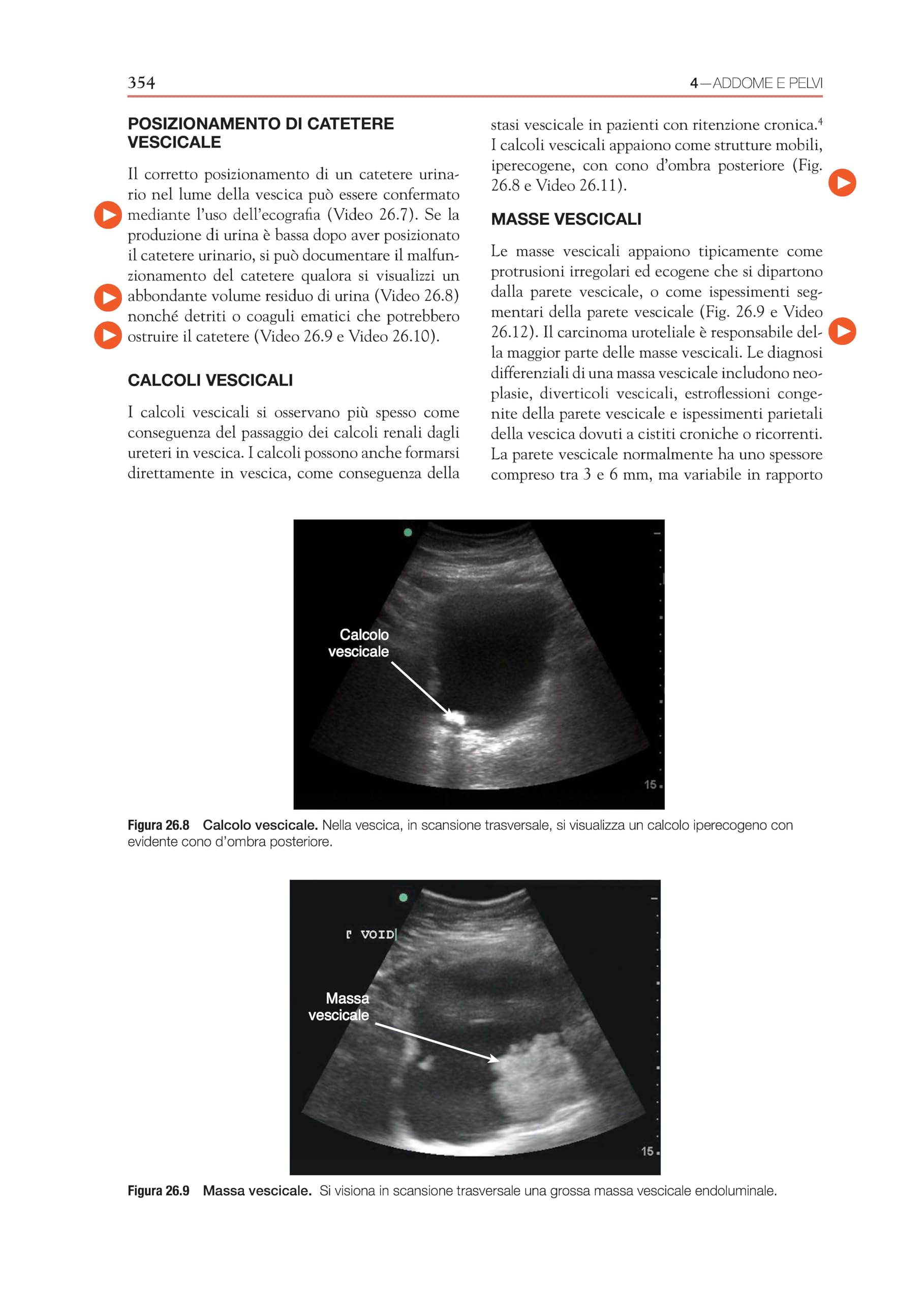 Ecografia. Point-of-care