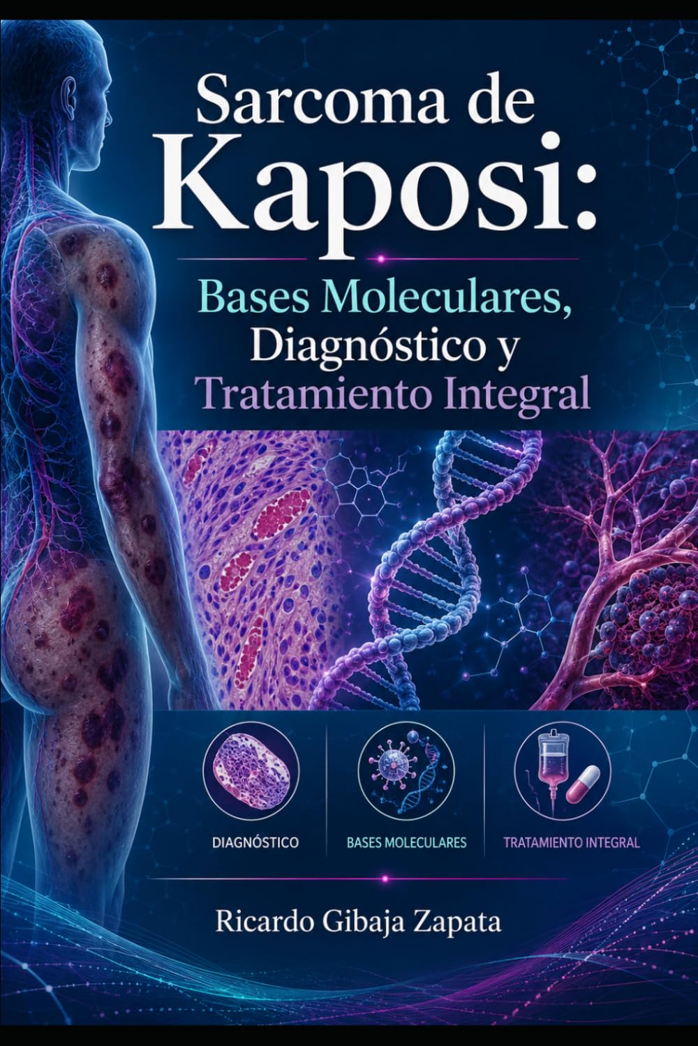 Sarcoma de Kaposi: Bases Moleculares, Diagnóstico y Tratamiento Integral