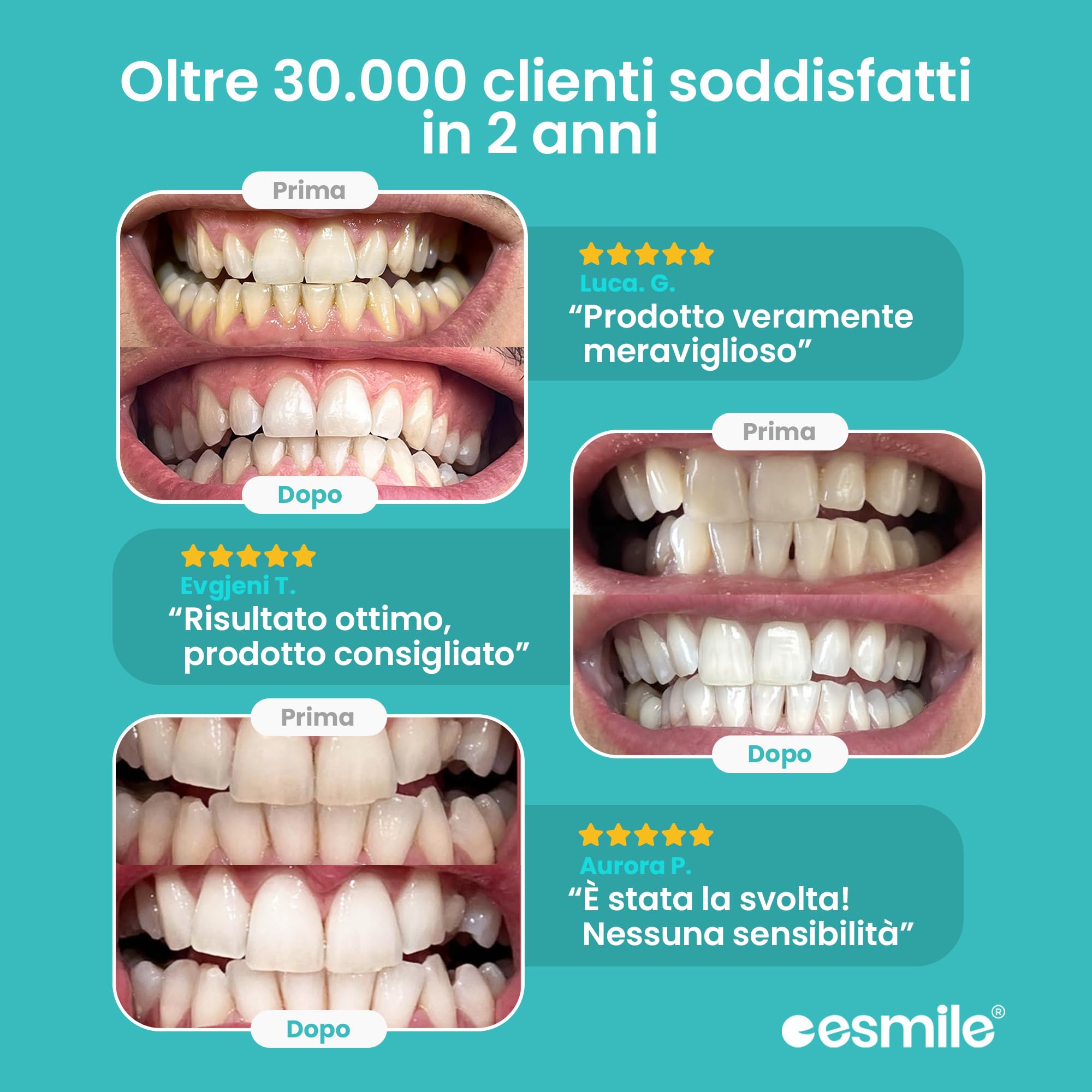 ESMILE: Kit EASYSMILE + Carbine Viola 100g