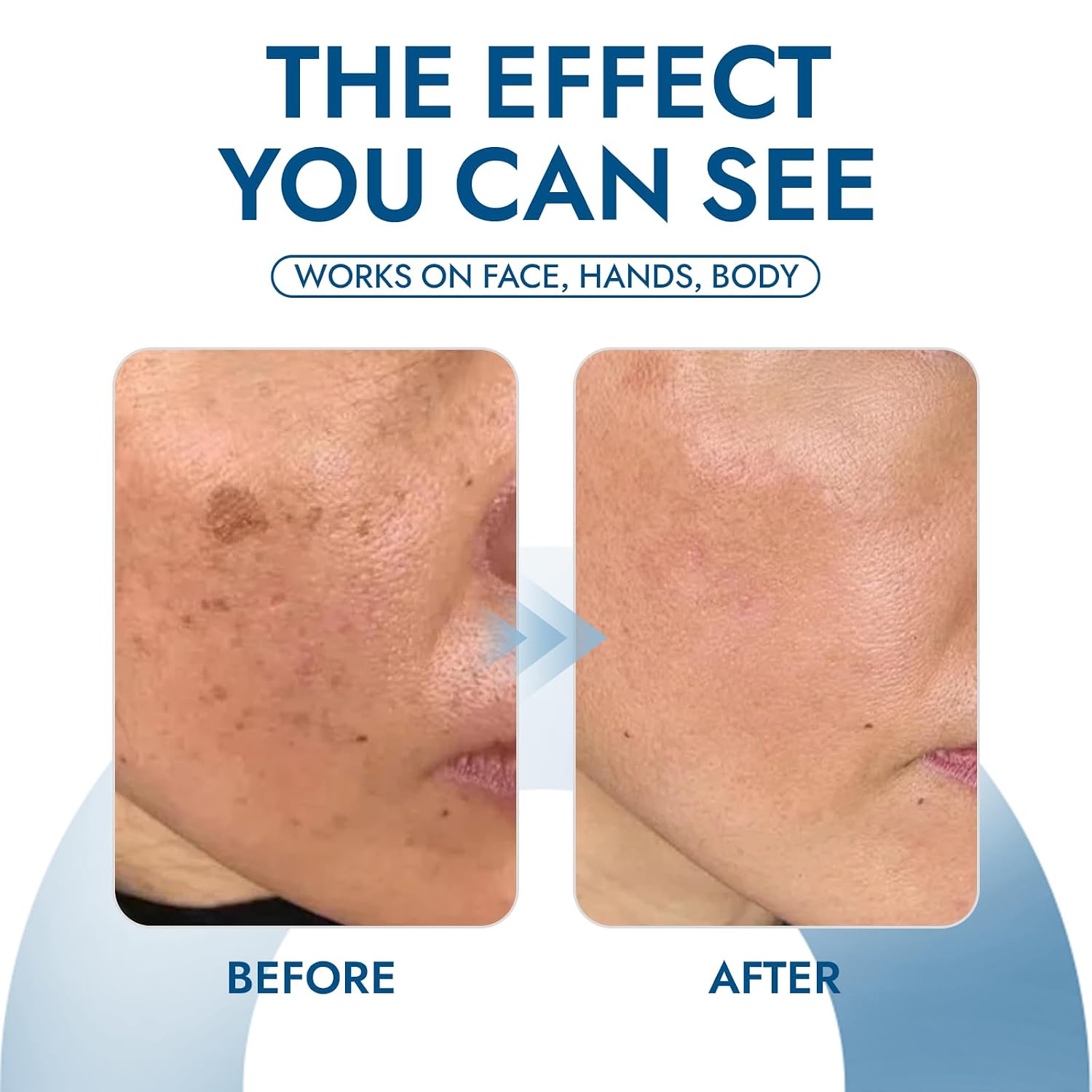 Claranova Lavouria Age Spot Cream, Dark Spot Corrector for Face, Hands & Body, Tranexamic Acid + Niacinamide, Helps Fade Age Spots, Sun Spots & Uneven Skin Tone, Fast-Absorbing, Non-Greasy(1pc)