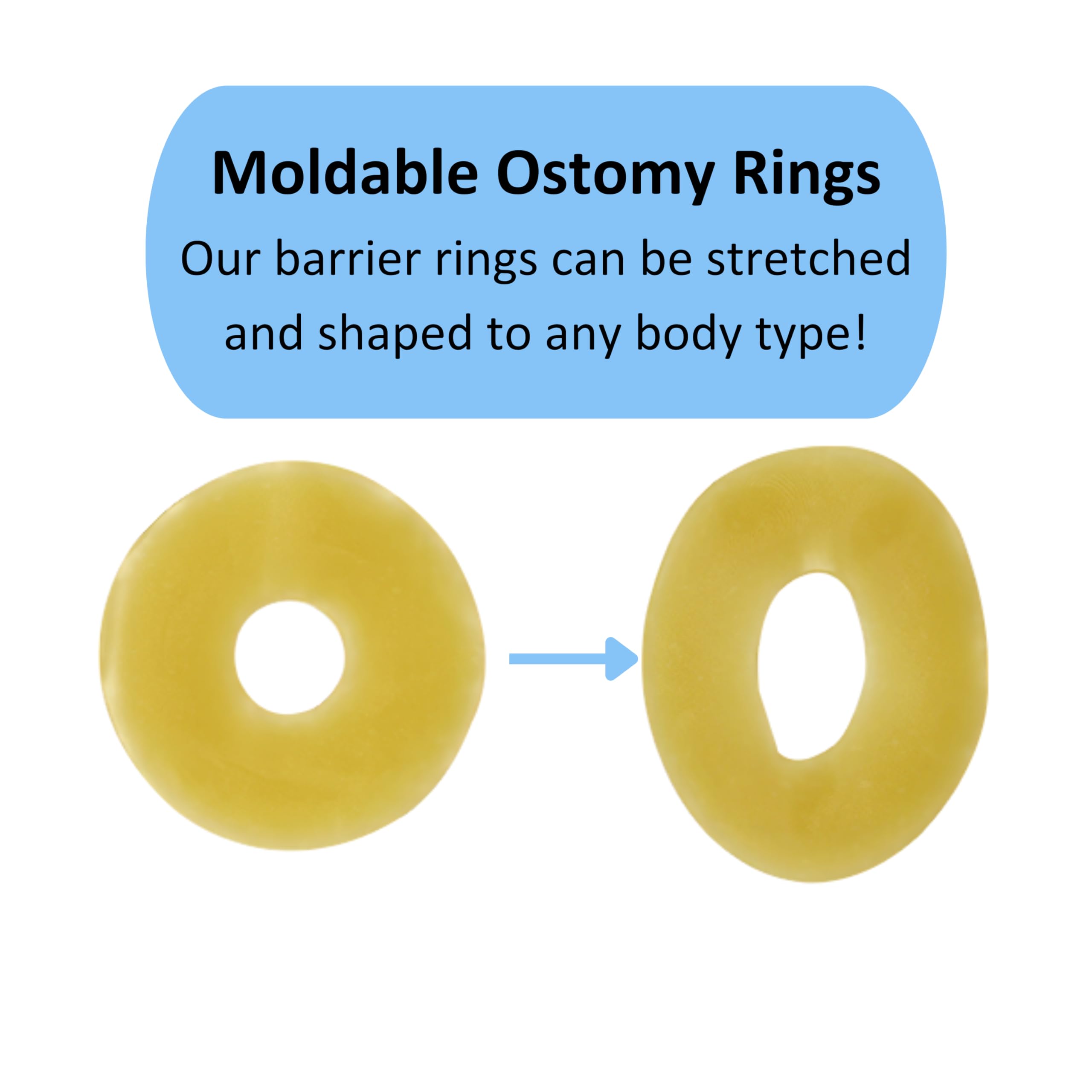 20 anillos de barrera moldeables para ostomía, 5 cm de diámetro, 4 mm de grosor, suministros de ostomía hidrocoloide médica, anillos de barrera sin fugas para bolsa de ostomía, bolsas de colostomía,