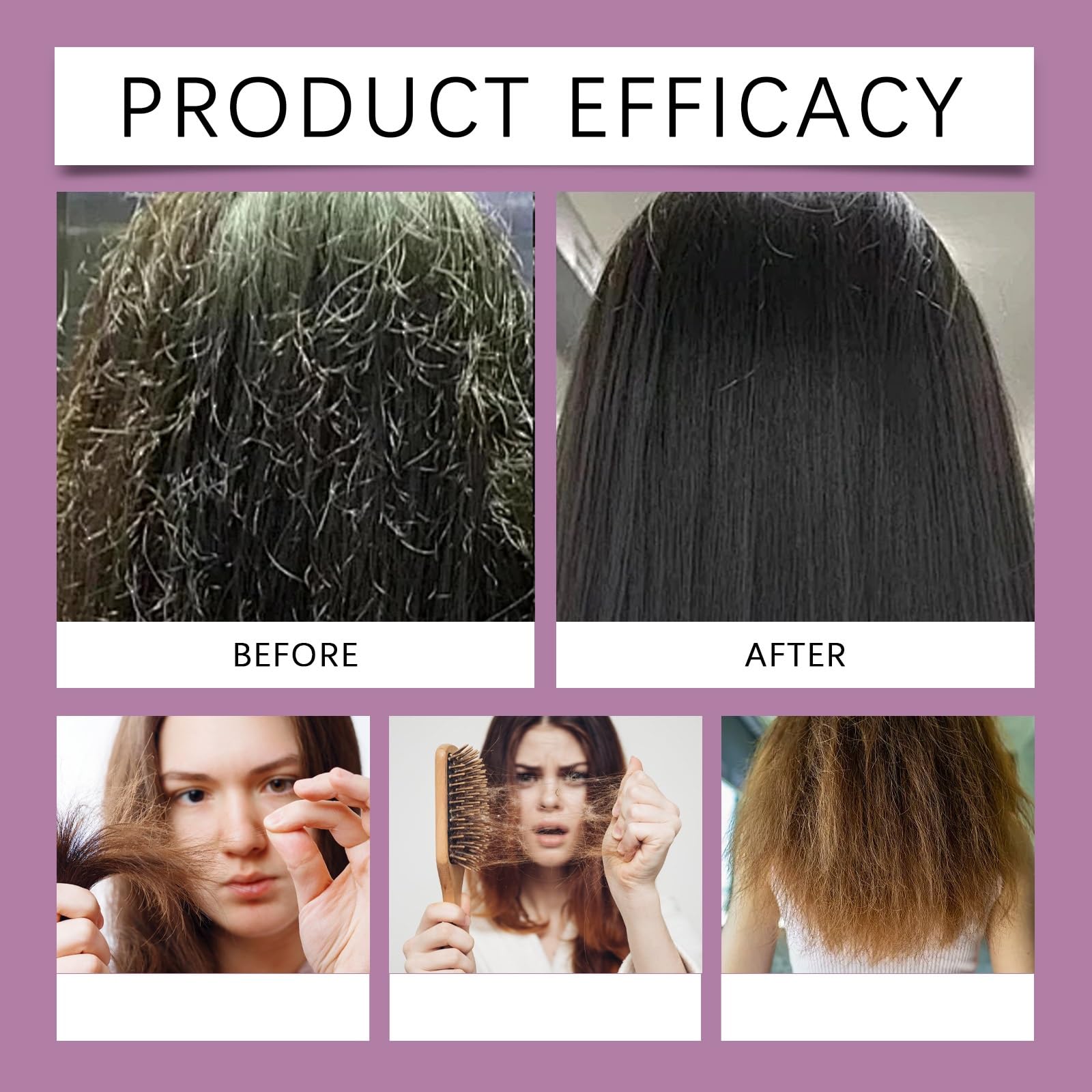XINRAN Cipolla rosmarino, olio per capelli, cipolla biotina, olio di rosmarino, siero per la crescita dei capelli, addensare a secco, facile da non grasso, lavare liberamente spray per la cura del