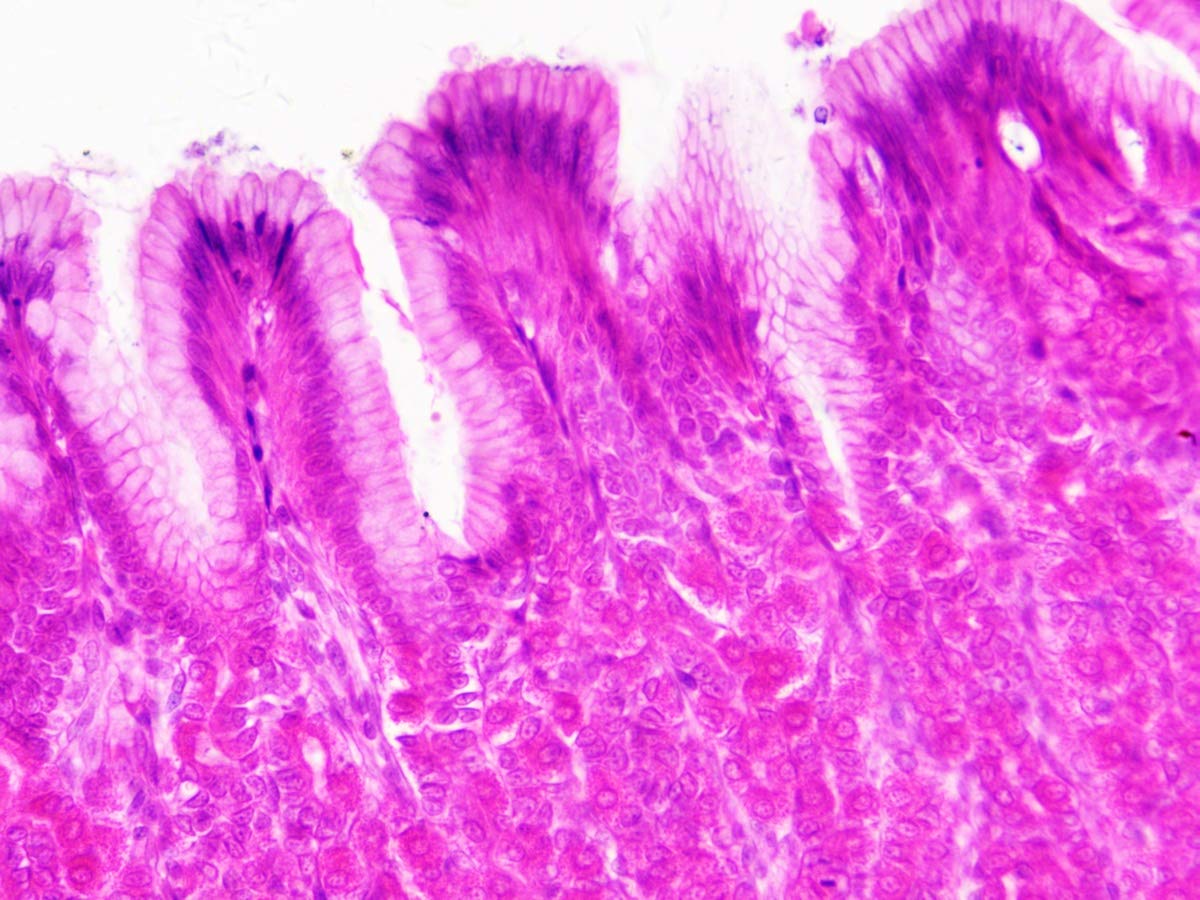 Bresser Muestras Preparadas: Histología