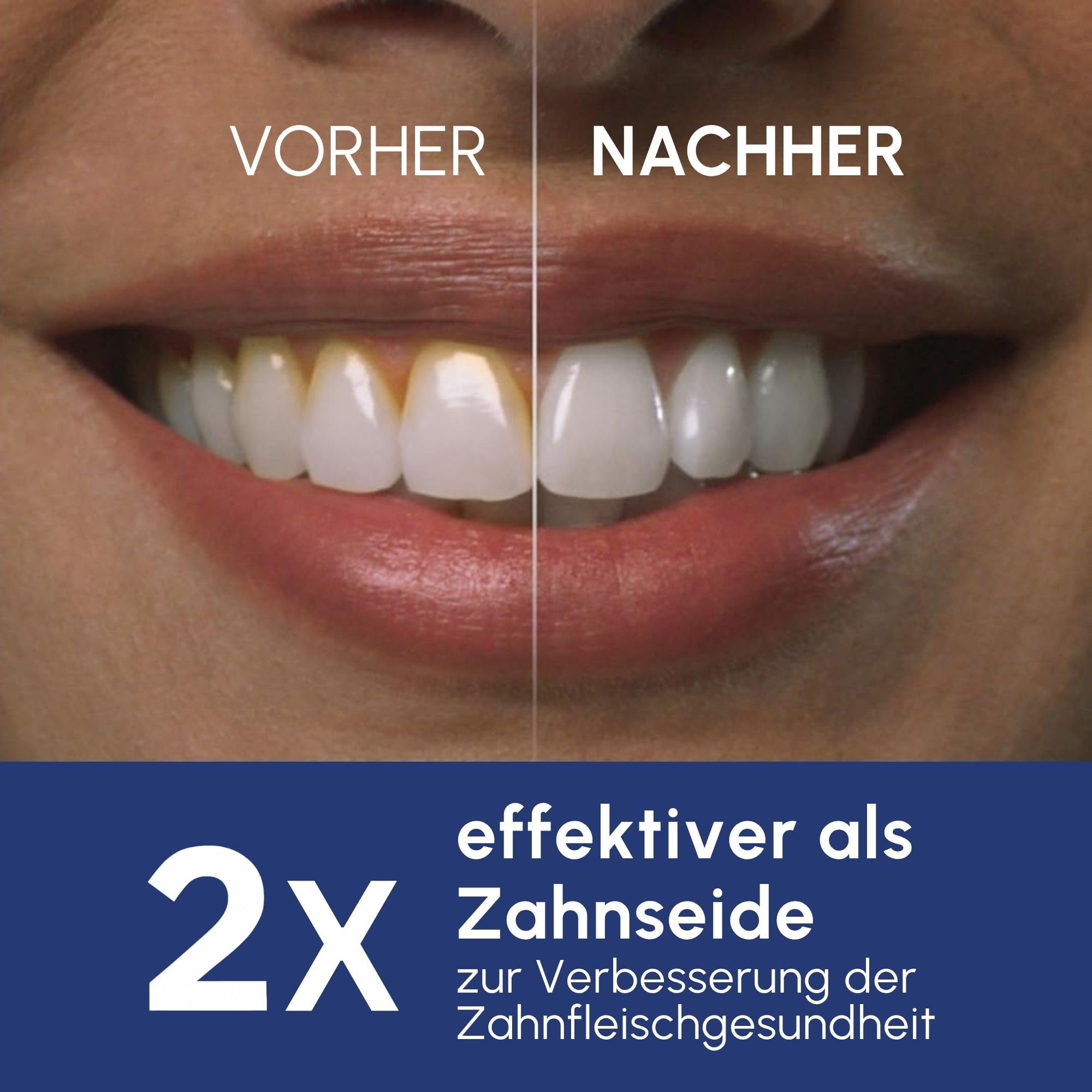 Waterpik Professional Water Flosser, Testsieger 2025, Precision Pulse Technology, TÜV Siegel, bis zu 99,9 Prozent Plaque Entfernung, 6x Aufsätze, 10x individuelle Modi, integrierter Timer, Schwarz