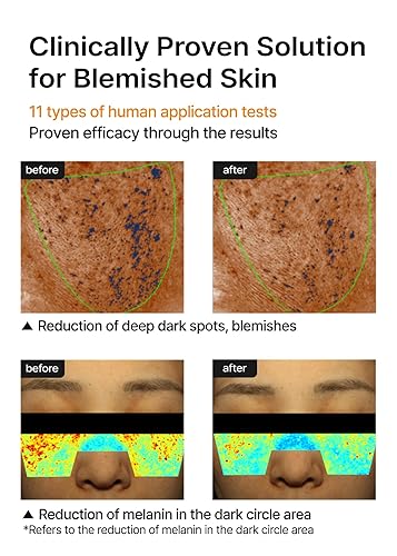 Miniatura 5 de celimax Crema iluminadora Pore+Dark Spot  con niacinamida, ácido tranexámico, crema TXA, minimizador de poros, no irritante, hidratante, para pieles