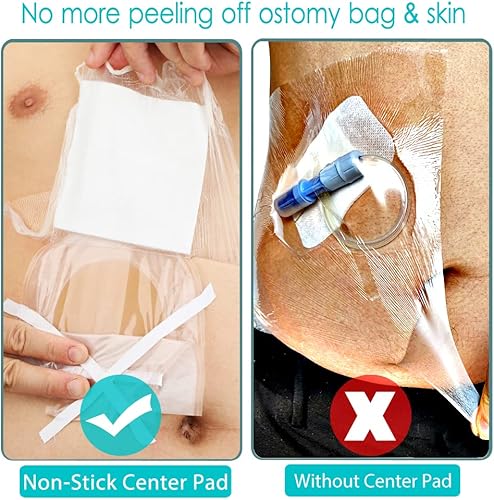 Miniatura 4 de Waterproof Ostomy Bag Shower Cover with Non Sticky Pad Colostomy Ilostomy Urlostomy Pouch Shower Guard Shield