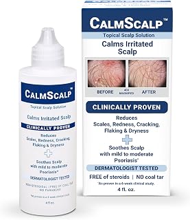 Topical Solution for Symptoms of Mild to Moderate Psoriasis | Irritated Scalp | Hairline Scales | Redness | 4 oz.