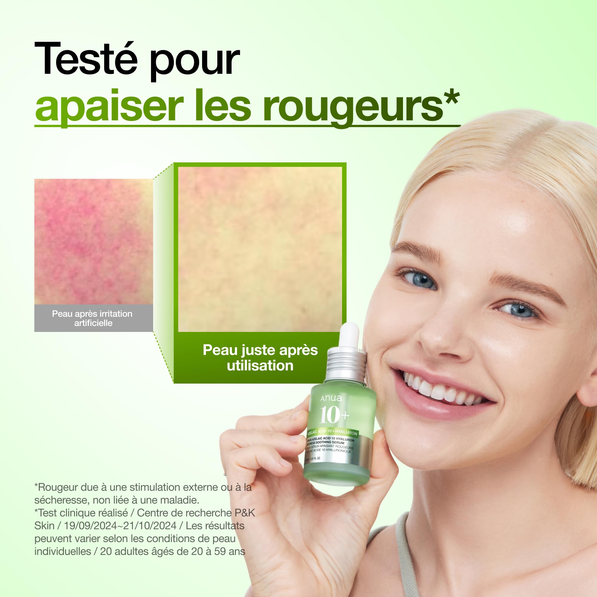 Anua Sérum Acide Azélaïque 10% – Serum Visage Apaisant Rougeurs & Imperfections, Acide Hyaluronique & Niacinamide, Peau Sensible, Skincare Coréenne, (30ml/ 1.01 fl oz.)
