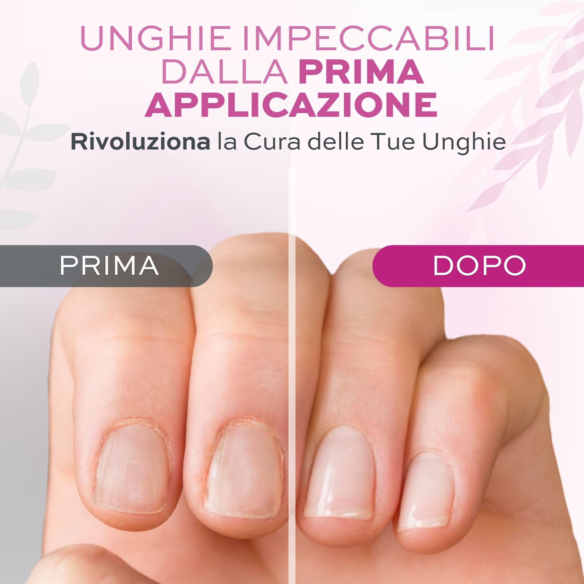 Rimuovi Cuticole Unghie di Mani e Piedi Professionale 12 ml - Scioglie e Rimuove Cuticole Trattamento per Unghie di Mani e Piedi