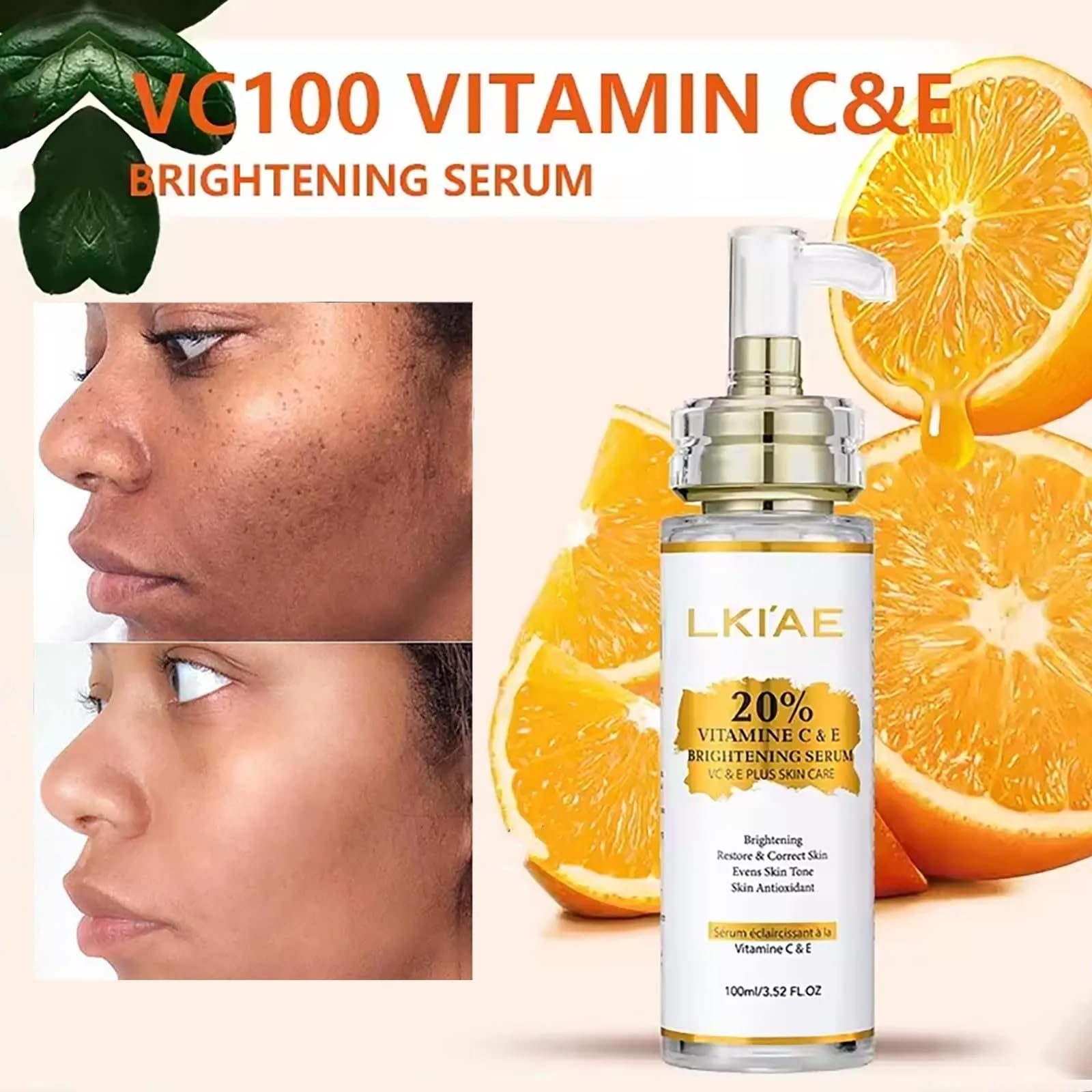 AILKE - Set schiarente 4 in 1 con vitamina C, schiarente, riduce macchie scure, rughe, pelle liscia, anti-invecchiamento, con niacinamide, glicerina, idratante per la pelle, per uomini e donne