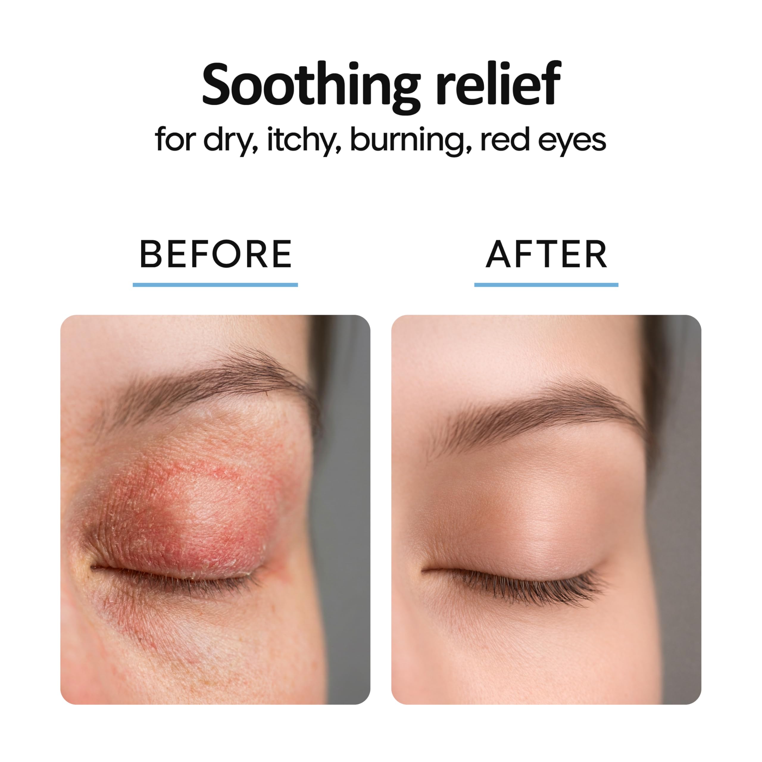 Eyelid Cleanser Spray 8oz | Blepharitis Treatment | Lid and Eyelash Cleaner — Amazon image 3