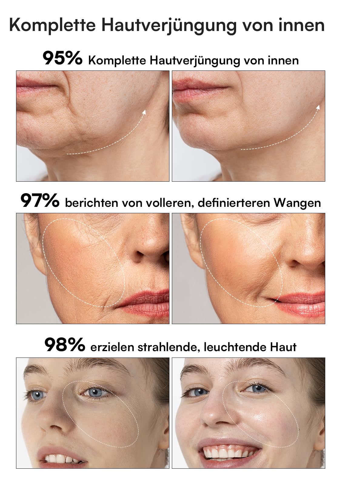 INIA Professionelles 3-in-1 Anti-Falten Gesichtsmassagegerät mit Mikrostrom & Rotlichttherapie Straffendes Lifting-Gerät für Gescht/Hals, Reduziert Schwellungen & Falten Firm