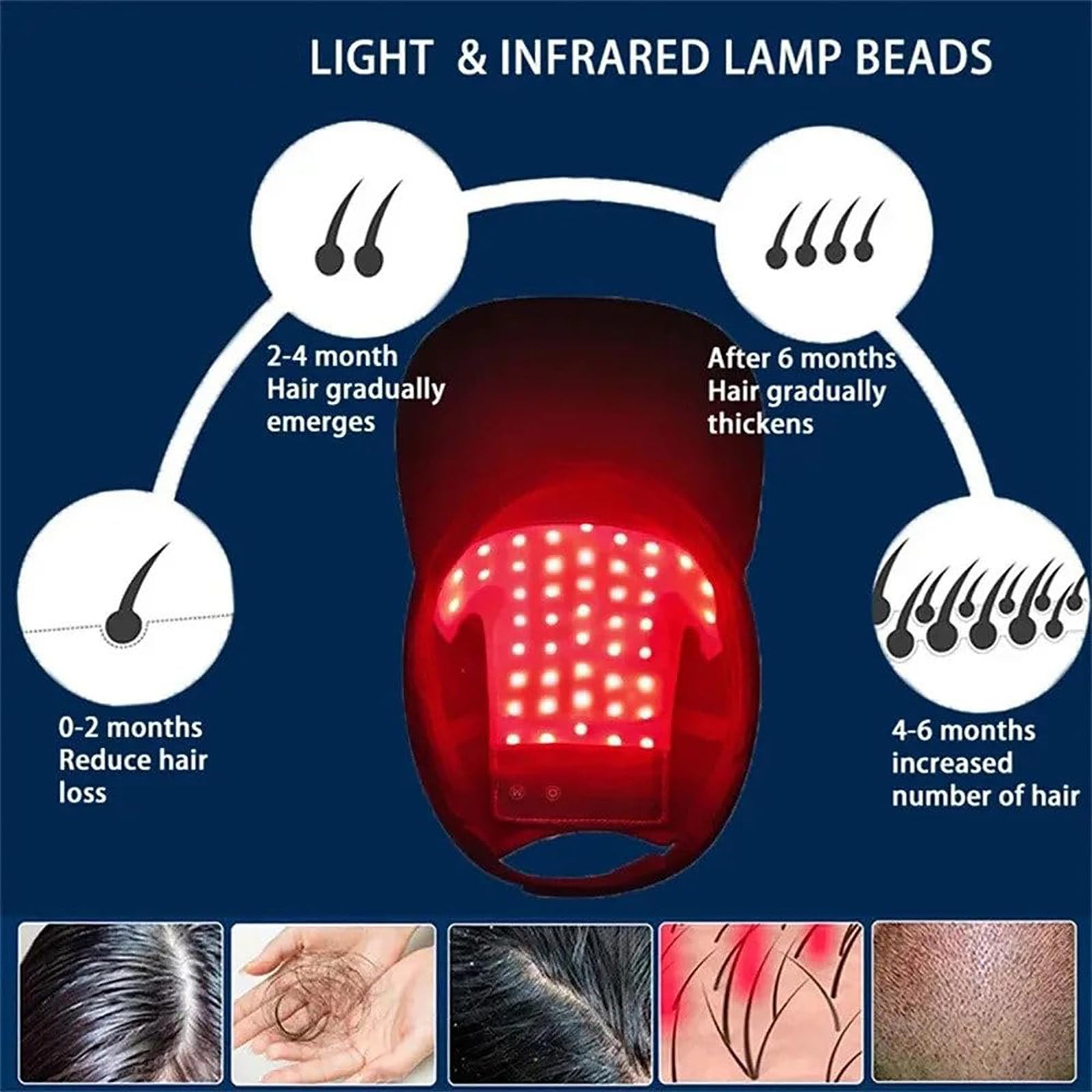 Gorro para El Crecimiento del Cabello (48 Led), Gorro para El Crecimiento del Cabello con Luz Roja Y Azul, 4 Modos, Control De Aceite, Promueve El Crecimiento RáPido del Cabello
