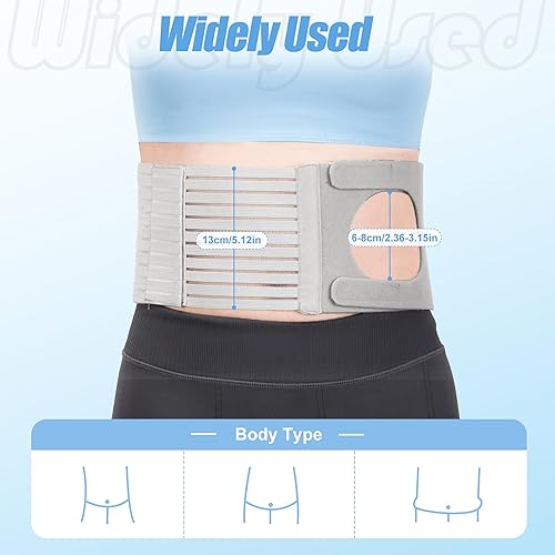 Miniatura 2 de Cinturón ajustable para hernia de ostomía para hombres y mujeres, diseño en forma de U, cinturón de soporte para estoma que evita hernia parastomal,