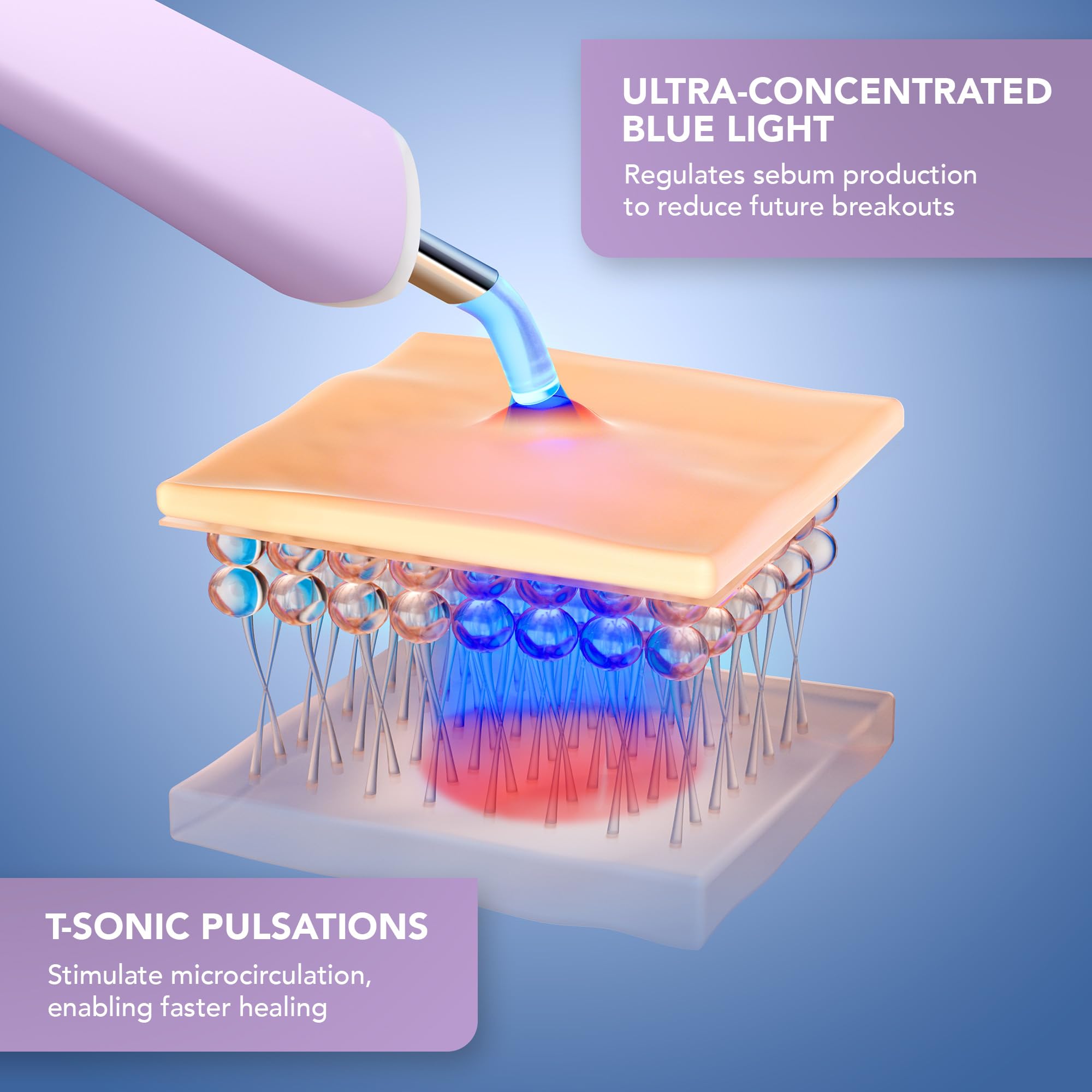 FOREO ESPADA 2 plus Precise Targeting - Skin Care Device for Blemish Treatment - Medical-grade Silicone - Scar & Spot Treatment for Face - Clear Skin – Lavender