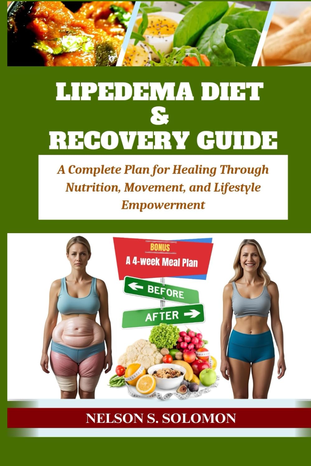 Lipedema Diet & Recovery Guide: A Complete Plan for Healing Through Nutrition, Movement, and Lifestyle Empowerment