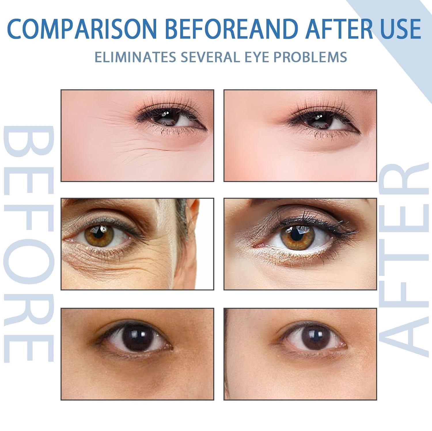 Seurico Peptyd Depuffing Eye Serum, Peptyd Depuffing Eye Żel, Lifts Firming Anti-Wrinkle Eye Tightener, nawilżający krem do oczu, redukcja ciemnych kółek, torby pod oczami (5 szt.)