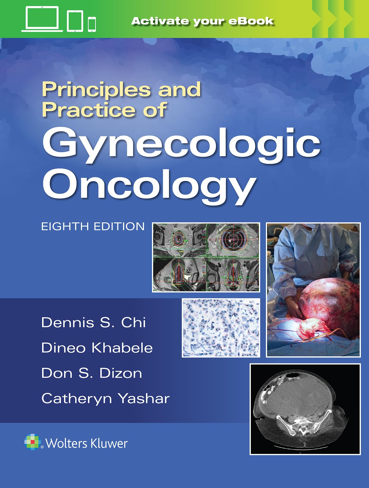 Principles and Practice of Gynecologic Oncology. Chi, Berchuck, Dizon, Yashar**