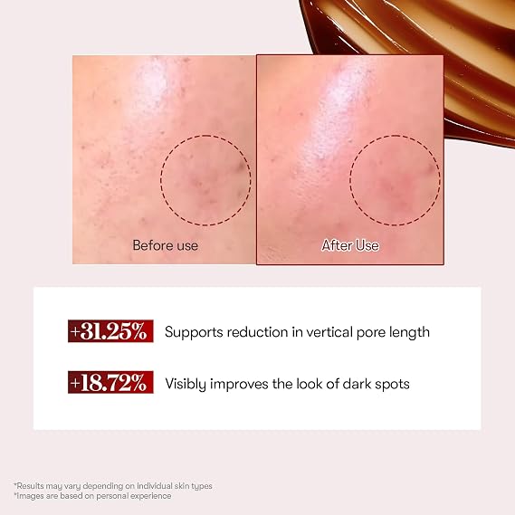 VT COSMETICS Red Booster Reedle Shot 100 Microneedling Serum with Dragon Blood, 50 ml, for Irritated and Sun-Strained Skin