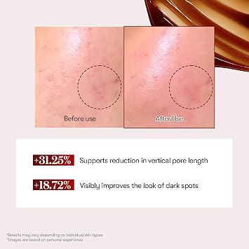 VT COSMETICS Red Booster Reedle Shot 100 Microneedling Serum with Dragon Blood, 50 ml, for Irritated and Sun-Strained Skin