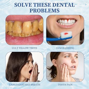 Pack of 2 Hydroxyapatite Toothpaste Toothpaste Hydroxyapatite Toothpaste with Hydroxyapatite Hydroxyapatite Toothpaste Without Fluoride Toothpaste for Repairing Caries Strengthens Remineralisation Toothpaste