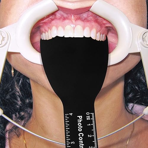Miniatura 2 de Annhua Kit de fotografía intraoral para contratista dental, kit de contraste de fotos dentales, kit de fotografía intraoral palatina, tablero de