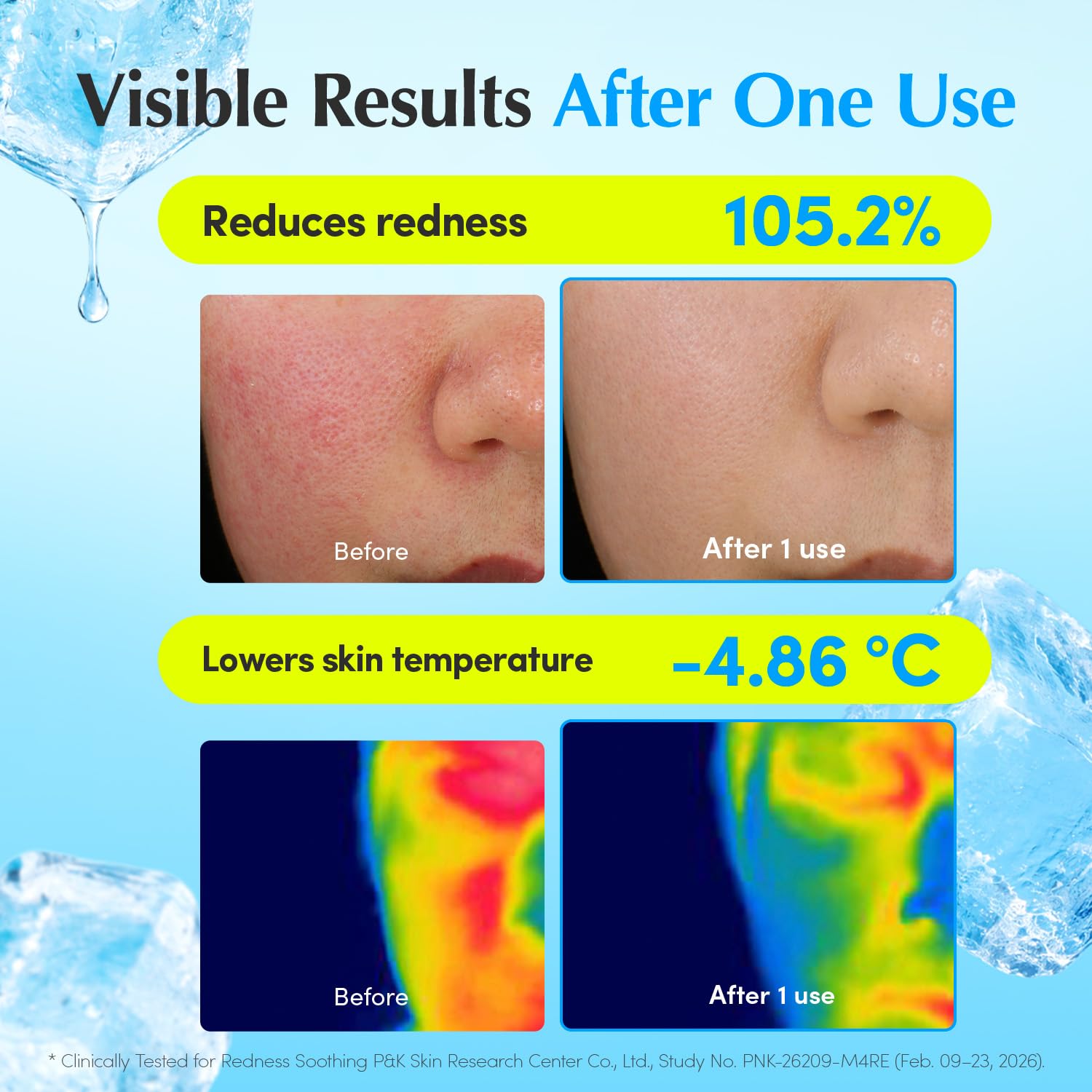 EQQUALBERRY Hyaltoin Flooding Cream Hyaluronic Acid Gel Moisturizer