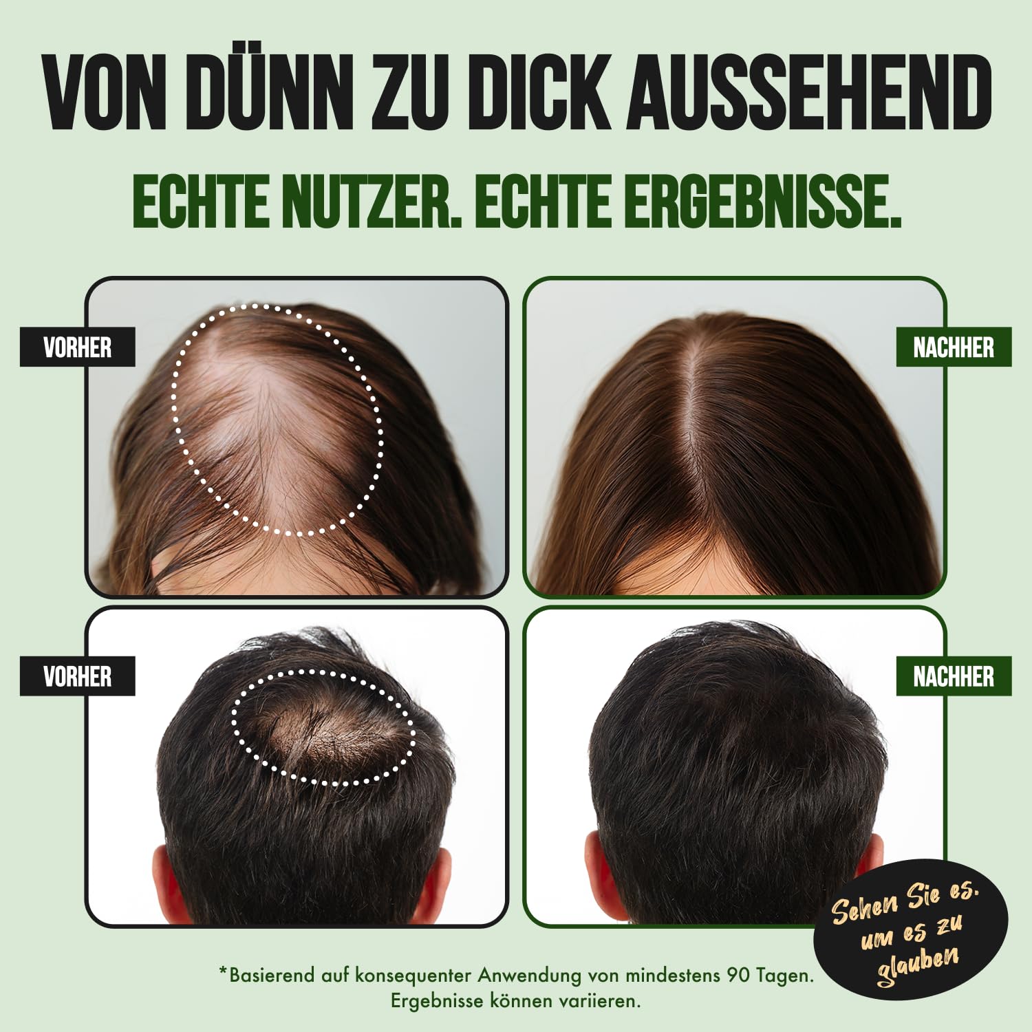 Haarwuchs-Spray – Für Frauen & Männer | Unterstützt das Haarwachstum & kräftiger aussehendes Haar | Mit Biotin, Koffein, Rizinusöl & Aminexil | 1-Monatsvorrat