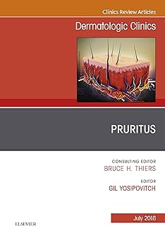 Pruritus, An Issue of Dermatologic Clinics (The Clinics: Dermatology Book 36)