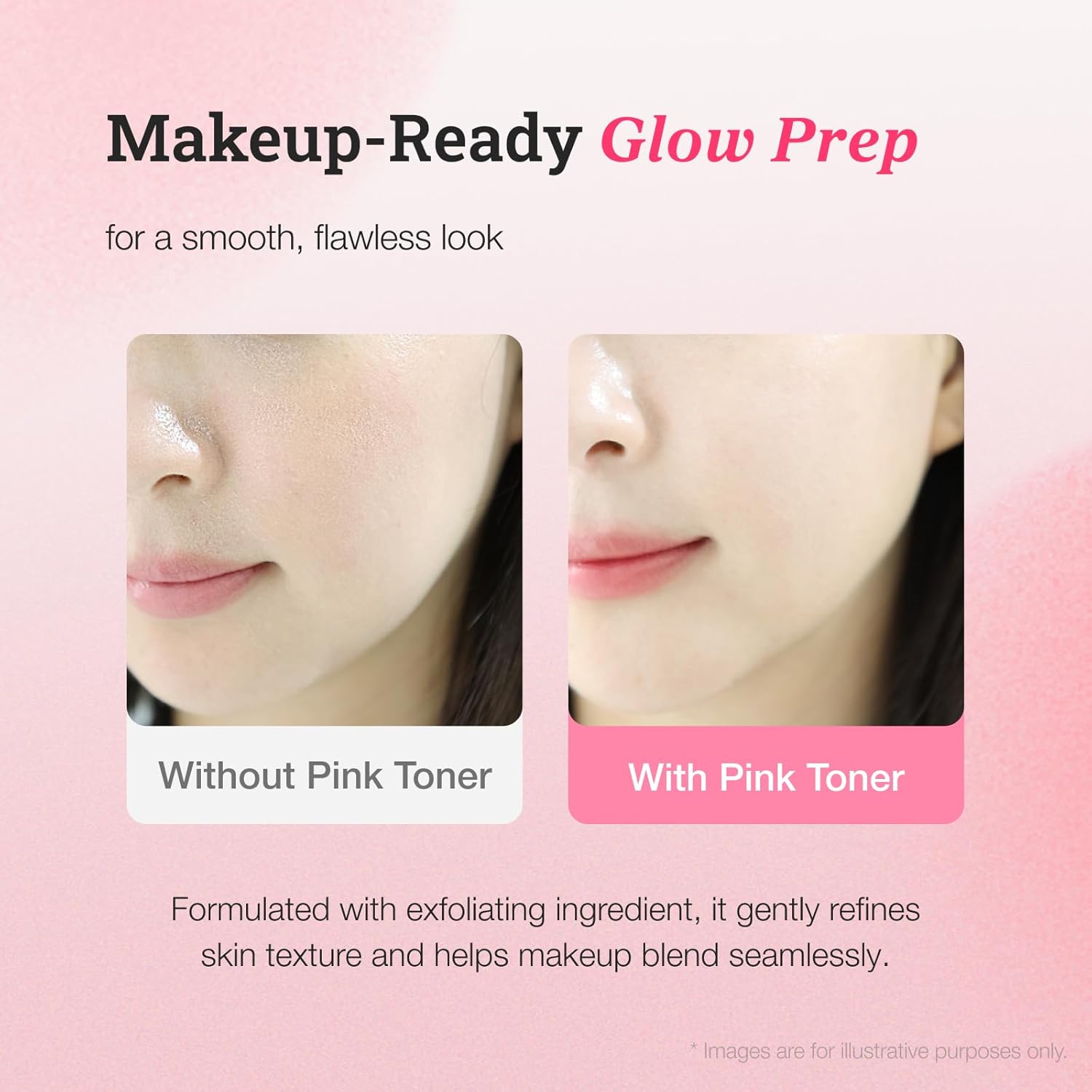 CNP Pink Toning™ Toner, PDRN + Tranexamic Acid Toner for Face, Salmon DNA, Niacinamide, for Glass Skin, Korean Skincare, 6.7 fl. oz.