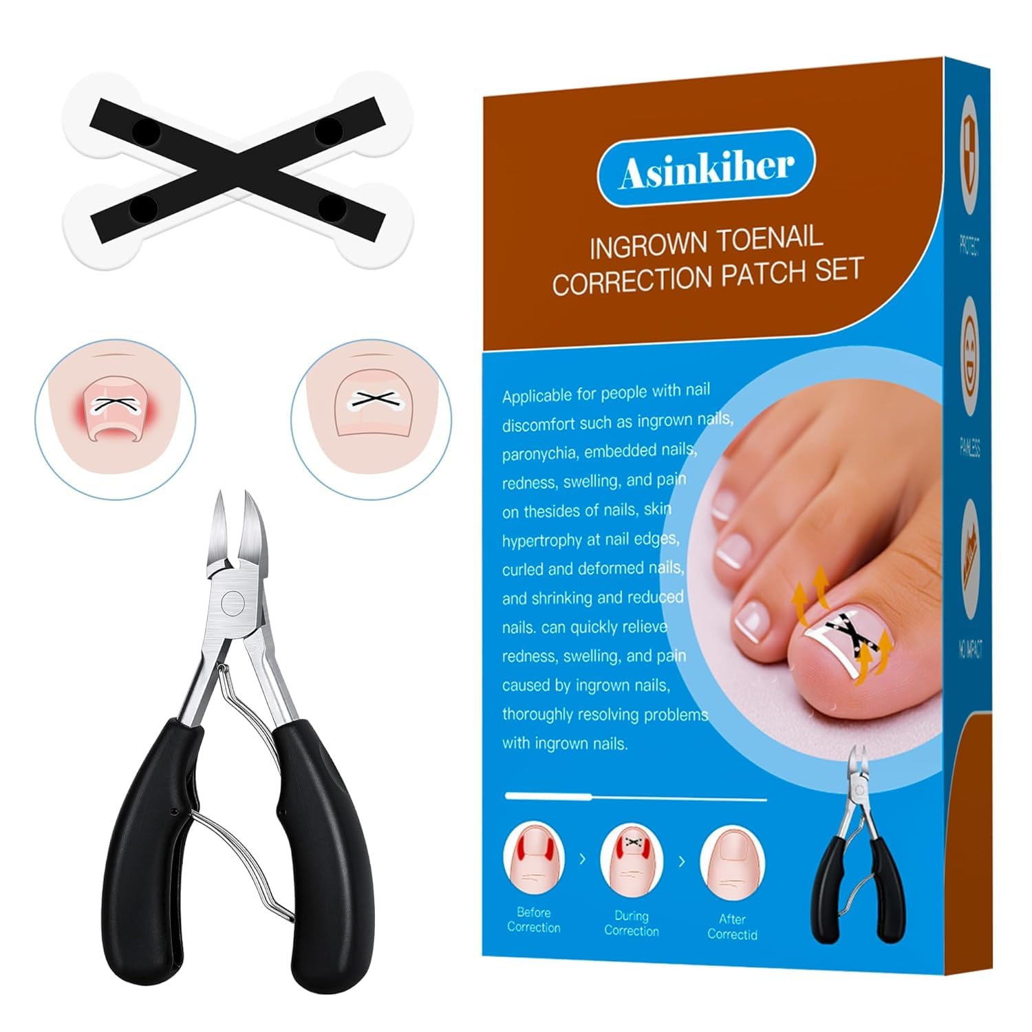 Ingrown Toenail Treatment Kit - Upgraded X-Type Titanium Alloy Corrector 0.59in